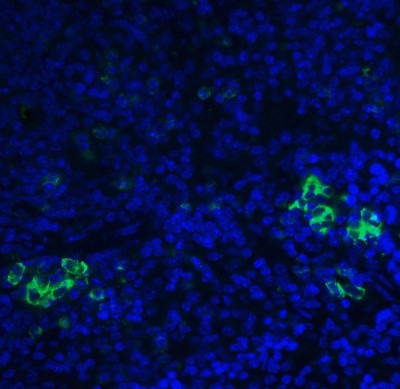 Immunofluorescence: TLR3 Antibody [NBP1-76659] - TLR3 in mouse spleen tissue with TLR3 antibody at 20 ug/ml.