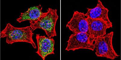 Immunocytochemistry/Immunofluorescence: GR/NR3C1 Antibody [NB300-610] - Analysis of Glucocorticoid Receptor using Glucocorticoid Receptor Polyclonal Antibody shows staining in Hela Cells. Glucocorticoid Receptor (green), F-Actin staining with Phalloidin (red) and nuclei with DAPI (blue) is shown. Cells were grown on chamber slides and fixed with formaldehyde prior to staining. Cells were probed without (control) or with an antibody recognizing Glucocorticoid Receptor at a dilution of 1:20 over night at 4C, washed with PBS and incubated with a DyLight-488 conjugated.
