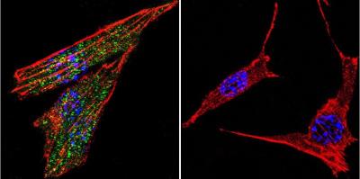 Immunocytochemistry/Immunofluorescence: GR/NR3C1 Antibody [NB300-610] - Analysis of Glucocorticoid Receptor using Glucocorticoid Receptor Polyclonal Antibody shows staining in NIH-3T3 Cells. Glucocorticoid Receptor (green), F-Actin staining with Phalloidin (red) and nuclei with DAPI (blue) is shown. Cells were grown on chamber slides and fixed with formaldehyde prior to staining. Cells were probed without (control) or with an antibody recognizing Glucocorticoid Receptor at a dilution of 1:20 over night at 4C, washed with PBS and incubated with a DyLight-488 conjugated.