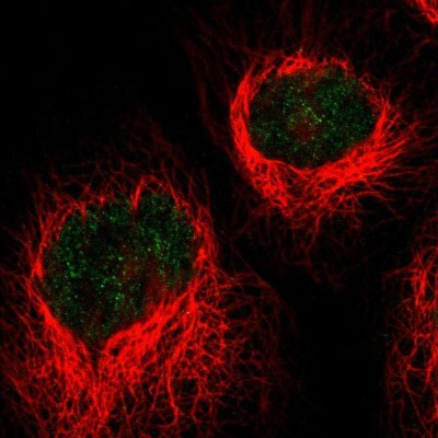 Immunocytochemistry/Immunofluorescence: HLTF Antibody [NBP1-83256] - Immunofluorescent staining of human cell line A-431 shows localization to nucleoplasm.