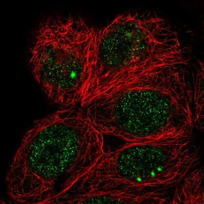 Immunocytochemistry/Immunofluorescence: Tsukushi/TSK Antibody [NBP1-87959] - Staining of human cell line MCF7 shows positivity in nucleus.