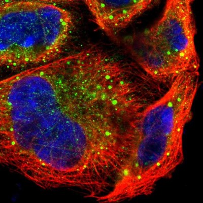 Immunocytochemistry/Immunofluorescence: P-Rex1 Antibody [NBP1-93590] - Immunofluorescent staining of human cell line A-431 shows localization to cytosol & vesicles.