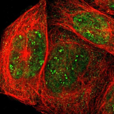 Immunocytochemistry/Immunofluorescence: Aldolase C Antibody [NBP1-90954] - Staining of human cell line A-431 shows localization to nucleus, nucleoli fibrillar center & cytosol.