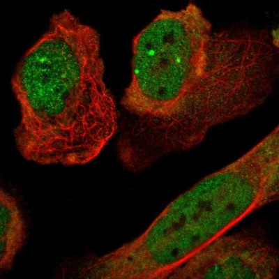 Immunocytochemistry/Immunofluorescence: p57 Kip2 Antibody [NBP1-89917] - Staining of human cell line U-2 OS shows localization to nucleoplasm, nuclear bodies & cytosol.
