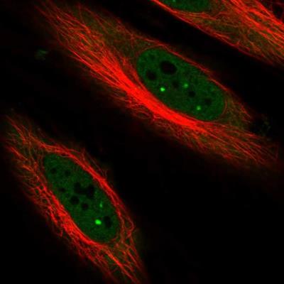 Immunocytochemistry/Immunofluorescence: p57 Kip2 Antibody [NBP1-89917] - Staining of human cell line HeLa shows positivity in nucleus but excluded from the nucleoli.
