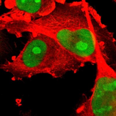 Immunocytochemistry/Immunofluorescence: PHF6 Antibody [NBP1-88646] - Immunofluorescent staining of human cell line U-251 MG shows localization to nucleus & nucleoli.