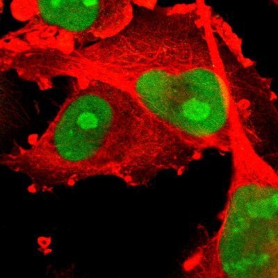 Immunocytochemistry/Immunofluorescence: PHF6 Antibody [NBP1-88646] - Staining of human cell line U-251MG shows positivity in nucleus and nucleoli.