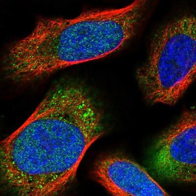 Immunocytochemistry/Immunofluorescence: Isoleucyl tRNA synthetase Antibody [NBP1-87698] - Staining of human cell line U-251MG shows positivity in nucleus but not nucleoli and cytoplasm.