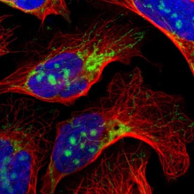 Immunocytochemistry/Immunofluorescence: IDH3G Antibody [NBP1-85810] - Immunofluorescent staining of human cell line U-2 OS shows localization to nucleoli & mitochondria.