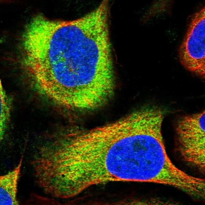 Immunocytochemistry/Immunofluorescence: NAA10 Antibody [NBP2-33934] - Immunofluorescent staining of human cell line U-2 OS shows localization to cytosol.