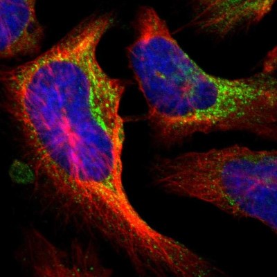 Immunocytochemistry/Immunofluorescence: P4HA1 Antibody [NBP1-84398] - Immunofluorescent staining of human cell line U-2 OS shows localization to endoplasmic reticulum & vesicles.