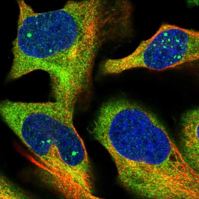 Immunocytochemistry/Immunofluorescence: HBS1L Antibody [NBP1-85123] - Immunofluorescent staining of human cell line U-2 OS shows localization to nuclear bodies & cytosol.