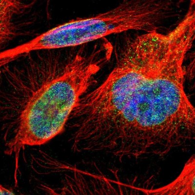 Immunocytochemistry/Immunofluorescence: NUP62 Antibody [NBP1-85091] - Immunofluorescent staining of human cell line U-251 MG shows localization to nuclear membrane.