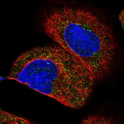 Immunocytochemistry/Immunofluorescence: HSD17B4 Antibody [NBP1-85296] - Staining of human cell line A-431 shows localization to peroxisomes.