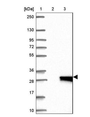 Western Blot: Cysteine Dioxygenase Type 1 Antibody [NBP2-33988] - Lane 1: Marker [kDa] 250, 130, 95, 72, 55, 36, 28, 17, 10. Lane 2: Negative control (vector only transfected HEK293T lysate). Lane 3: Over-expression lysate (Co-expressed with a C-terminal myc-DDK tag (3.1 kDa) in mammalian HEK293T cells).