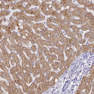 Immunohistochemistry-Paraffin: Cysteine Dioxygenase Type 1 Antibody [NBP2-33988] - Staining of human liver shows moderate cytoplasmic positivity in hepatocytes.