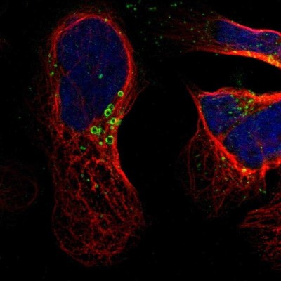 Immunocytochemistry/Immunofluorescence: hydroxysteroid (17-beta) dehydrogenase 11 Antibody [NBP1-90334] - Staining of human cell line U-2 OS shows localization to lipid droplets.