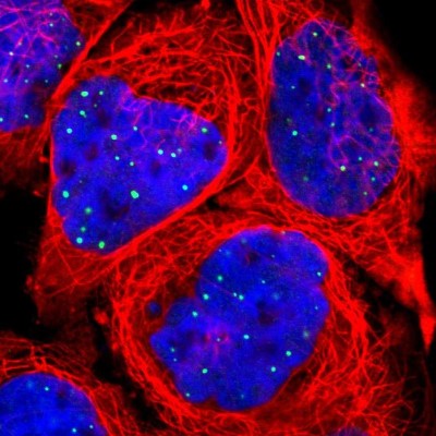 Immunocytochemistry/Immunofluorescence: CLIC3 Antibody [NBP1-89465] - Immunofluorescent staining of human cell line A-431 shows localization to nuclear bodies.