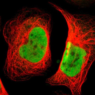 Immunocytochemistry/Immunofluorescence: BAF57 Antibody [NBP1-90012] - Immunofluorescent staining of human cell line U-2 OS shows localization to nucleoplasm.
