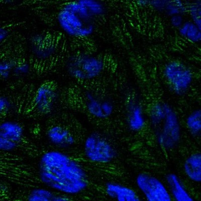 Immunocytochemistry/Immunofluorescence: BTBD7 Antibody [NBP2-14364] - Staining of human cell line RT4 shows localization to focal adhesion sites.