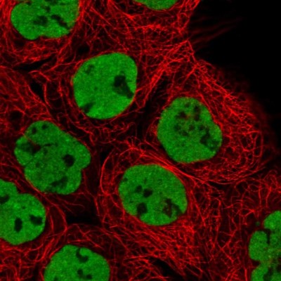 Immunocytochemistry/Immunofluorescence: hnRNP M1-M4 Antibody [NBP1-84555] - Immunofluorescent staining of human cell line A-431 shows localization to nucleoplasm.