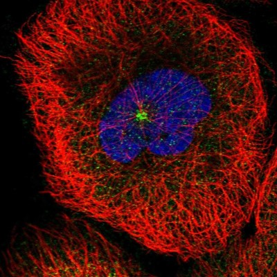 Immunocytochemistry/Immunofluorescence: MDM1 Antibody [NBP1-85839] - Immunofluorescent staining of human cell line A-431 shows localization to cytosol & centrosome.