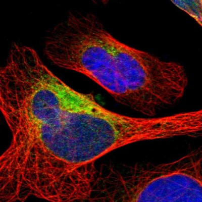Immunocytochemistry/Immunofluorescence: DNAJB11 Antibody [NBP1-84899] - Immunofluorescent staining of human cell line U-2 OS shows localization to endoplasmic reticulum.