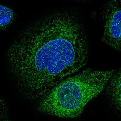 Immunocytochemistry/Immunofluorescence: LASS2 Antibody [NBP1-84537] - Immunofluorescent staining of human cell line A-431 shows localization to nuclear membrane & endoplasmic reticulum.