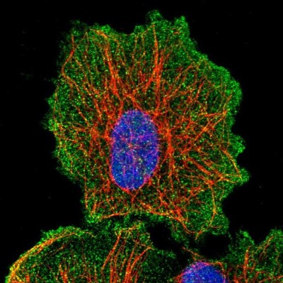 Immunocytochemistry/Immunofluorescence: CTNNA3 Antibody [NBP1-82728] - Staining of human cell line U-251MG shows positivity in plasma membrane and cytoplasm.