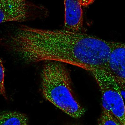 Immunocytochemistry/Immunofluorescence: ZCCHC11/TUT4 Antibody [NBP1-83027] - Immunofluorescent staining of human cell line U-251 MG shows localization to cytosol.