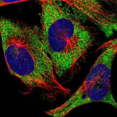 Immunocytochemistry/Immunofluorescence: Ataxin-2 Antibody [NBP1-90063] - Immunofluorescent staining of human cell line U-251 MG shows localization to cytosol.