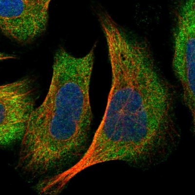 Immunocytochemistry/Immunofluorescence: DNAJC2 Antibody [NBP1-82627] - Immunofluorescent staining of human cell line U-2 OS shows localization to cytosol.