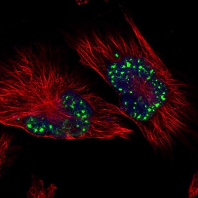 Immunocytochemistry/Immunofluorescence: SON Antibody [NBP1-88706] - Immunofluorescent staining of human cell line U-251 MG shows localization to nuclear speckles.