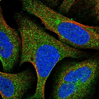 Immunocytochemistry/Immunofluorescence: ATP6V1D Antibody [NBP1-88895] - Staining of human cell line U-2 OS shows positivity in cytoplasm.