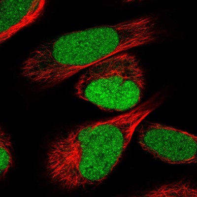 Immunocytochemistry/Immunofluorescence: IRF2BP2 Antibody [NBP1-93674] - Immunofluorescent staining of human cell line U-2 OS shows localization to nucleus.