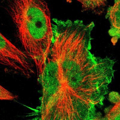 Immunocytochemistry/Immunofluorescence: IQGAP1 Antibody [NBP1-83143] - Staining of human cell line U-251 MG shows positivity in nucleus but not nucleoli, plasma membrane and cytoplasm.