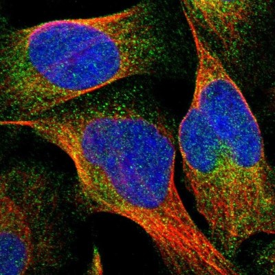 Immunocytochemistry/Immunofluorescence: TEX2 Antibody [NBP1-83156] - Staining of human cell line U-2 OS shows positivity in cytoplasm.