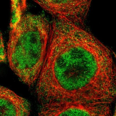 Immunofluorescence: TRIB2 Antibody [NBP1-83326] - Staining of human cell line A-431 shows positivity in cytoplasm and  nucleus but excluded from the nucleoli.