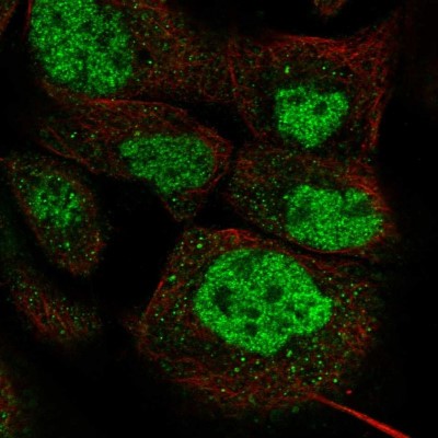 Immunocytochemistry/Immunofluorescence: DPF2 Antibody [NBP1-87138] - Immunofluorescent staining of human cell line A-431 shows localization to nucleoplasm.
