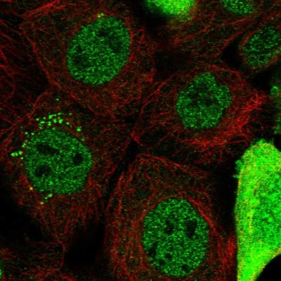 Immunocytochemistry/Immunofluorescence: CAPZB Antibody [NBP1-85922] - Immunofluorescent staining of human cell line A-431 shows localization to nucleoplasm, cytosol & vesicles.