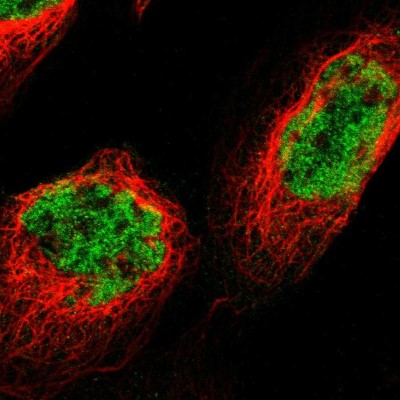 Immunocytochemistry/Immunofluorescence: p66 beta Antibody [NBP1-87358] - Immunofluorescent staining of human cell line A-431 shows localization to nucleoplasm.