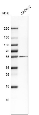 Western Blot: Asialoglycoprotein Receptor 2 Antibody [NBP1-85578] - Analysis in human cell line CACO-2.