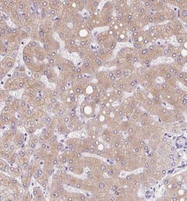 Immunohistochemistry-Paraffin: Asialoglycoprotein Receptor 2 Antibody [NBP1-85578] - Staining of human liver shows moderate cytoplasmic positivity in hepatocytes.