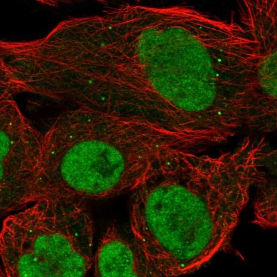 Immunocytochemistry/Immunofluorescence: PRDM10 Antibody [NBP1-81427] - Immunofluorescent staining of human cell line A-431 shows localization to nucleoplasm, nucleoli fibrillar center & vesicles.