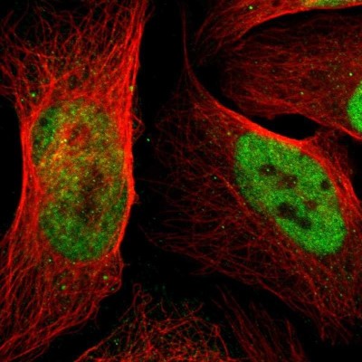 Immunocytochemistry/Immunofluorescence: p66 alpha Antibody [NBP1-87359] - Staining of human cell line U-2 OS shows localization to nucleoplasm.