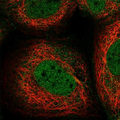 Immunocytochemistry/Immunofluorescence: TSPAN15 Antibody [NBP1-92540] - Staining of human cell line A-431 shows positivity in nucleus but not nucleoli and cytoplasm.