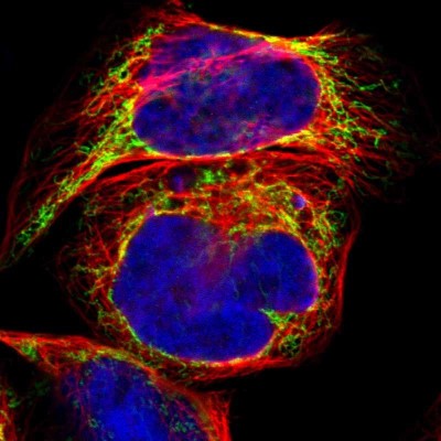 Immunocytochemistry/Immunofluorescence: ACAT1 Antibody [NBP1-89285] - Immunofluorescent staining of human cell line A-431 shows localization to mitochondria.