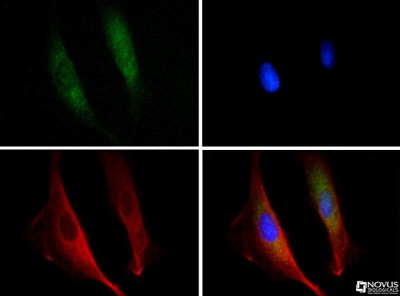 Immunocytochemistry/Immunofluorescence: DISC1 Antibody [NB110-40775] - DISC1 antibody was tested in PC-12 cells at 1:100 with Dylight 488 (green). Nuclei and alpha-tubulin were counterstained with DAPI (blue) and Dylight 549 (red).