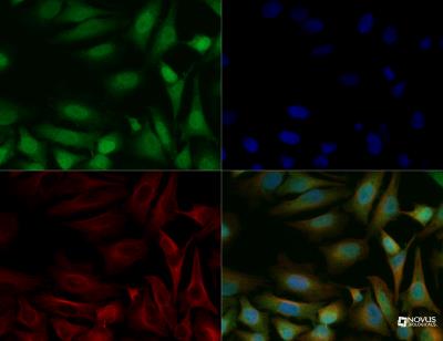 Immunocytochemistry/Immunofluorescence: FAM59A Antibody [NBP2-24573] - FAM59A antibody was tested in HeLa cells with DyLight 488 (green). Nuclei and alpha-tubulin were counterstained with DAPI (blue) and Dylight 550 (red).