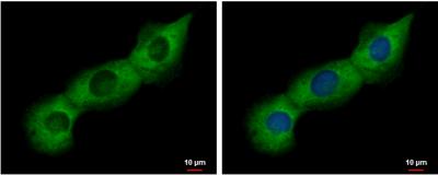 Immunocytochemistry/Immunofluorescence: PABP Antibody [NBP2-19670] - H1299 cells were fixed in 4% paraformaldehyde at RT for 15 min. Green: PABP protein stained by PABP antibody  diluted at 1:500. Blue: Hoechst 33342 staining.